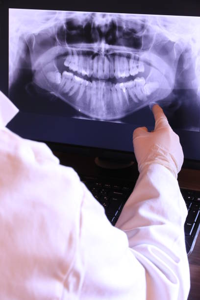 Best Knocked-Out Tooth (Avulsed Tooth) Treatment in Wasilla, AK