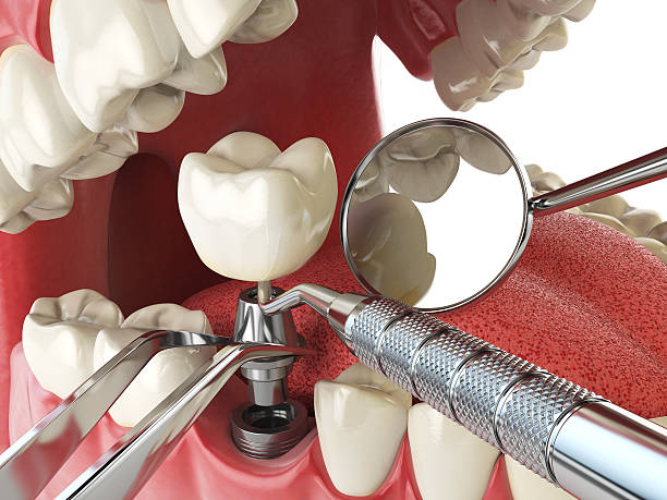 Best Emergency Denture Repair in Wasilla, AK